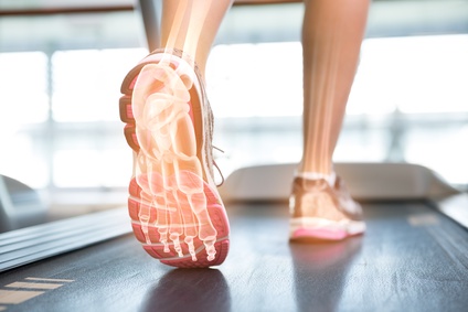 Common Overuse,  Lower Leg Injuries in the Runner
